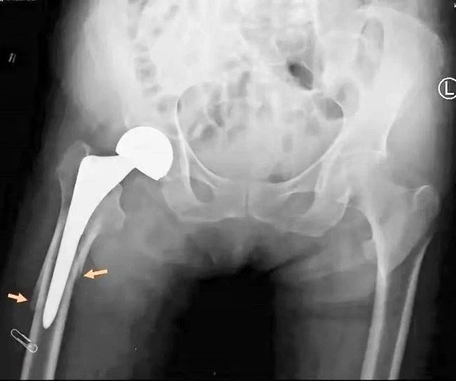 135415cnsbwn7tzzh8amer